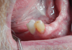 Figure 3: No. 28 crown delivered and cemented Figure 3: No. 28 crown delivered and cemented