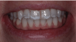 1906 D Edew P03 1906 D Edew P03