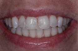 Figure 2: Before Icon treatment (top) and following Icon treatment and hydration (bottom) Figure 2: Before Icon treatment (top) and following Icon treatment and hydration (bottom)