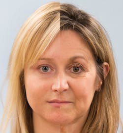 Figure 2: Split-face comparison clearly shows where aging has occurred.