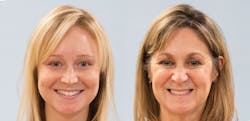 Figure 3: Comparison photo of mother and daughter smiling showing aging-related lip/smile line deficits.