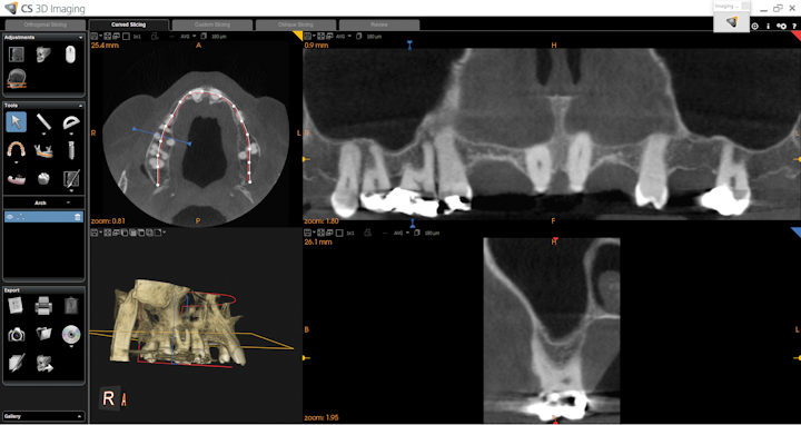 Figure 1: Using the CS 9300 imaging system, multiple views are available with an extensive tools menu.