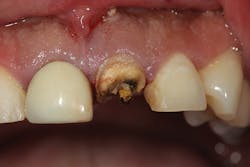 Figure 20: Type 1b socket Figure 20: Type 1b socket