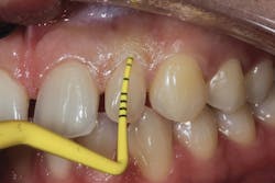 Figure 21: Type 1c socket Figure 21: Type 1c socket