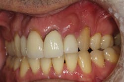 Figure 22: Type 2 socket Figure 22: Type 2 socket