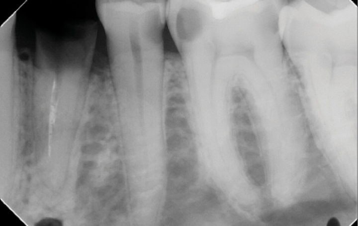 Economically And Clinically Leveraging Implantology In Your Solo Practice Dso Or Ddso Innovations In Immediate Implants Dental Economics