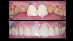 Figure 1: Accomplish the procedures that you like to do and with which you feel competent. How do you think this patient felt when the rehabilitation was completed, and how do you think I felt? Figure 1: Accomplish the procedures that you like to do and with which you feel competent. How do you think this patient felt when the rehabilitation was completed, and how do you think I felt?