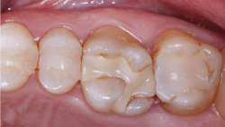 1909 De Cchr P01a 1909 De Cchr P01a