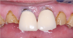 1909 De Cchr P02a 1909 De Cchr P02a