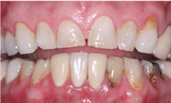 1909 De Cchr P03b 1909 De Cchr P03b