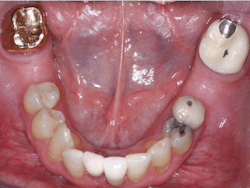 1909 De Cchr P04a 1909 De Cchr P04a