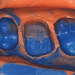 Figure 2: Optimal margin and flash capture that is typically inspected under magnification Figure 2: Optimal margin and flash capture that is typically inspected under magnification
