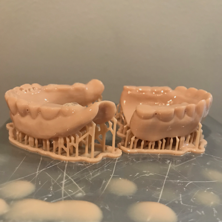 Figure 1: Unprocessed 3-D printed dentures