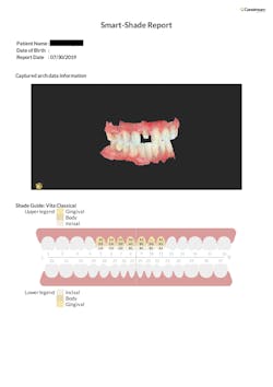 Figure 1: A shade-mapping report automatically generated by the scanner's software, CS ScanFlow Figure 1: A shade-mapping report automatically generated by the scanner's software, CS ScanFlow