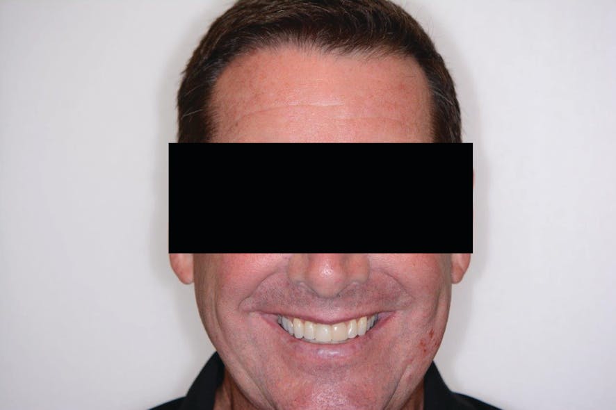 Figure 5: The happy patient