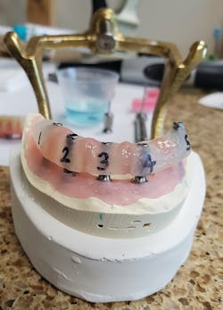 Figure 10: Luted verification jig tried on the master cast and checked for accuracy Figure 10: Luted verification jig tried on the master cast and checked for accuracy