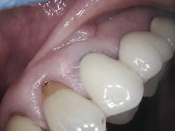 Figure 2: Pre-op Figure 2: Pre-op