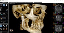 Figure 2: The question is no longer “Is 3-D better than 2-D?” As you can see, there’s no question about the unprecedented views 3-D provides. Instead, consider how you can capture 3-D images safely with low-dose modes. Figure 2: The question is no longer “Is 3-D better than 2-D?” As you can see, there’s no question about the unprecedented views 3-D provides. Instead, consider how you can capture 3-D images safely with low-dose modes.