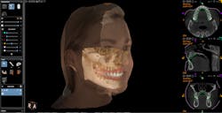 Figure 3: A virtual patient aids with treatment planning and helps patients envision their future smiles.