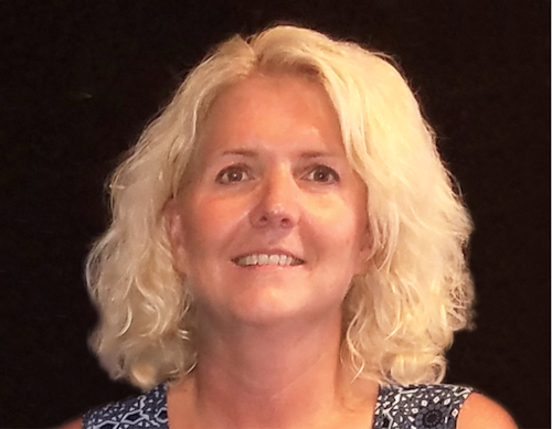 Figure 1: Marcy’s “before” photo shows large masseters and a strained smile because of her orofacial pain.