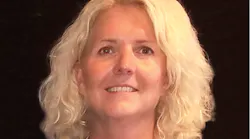 Figure 1: Marcy’s “before” photo shows large masseters and a strained smile because of her orofacial pain.