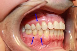 1911 De Caus P02 1911 De Caus P02