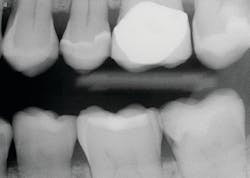 1912 De Cchr P04 1912 De Cchr P04