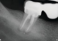 Figure 2: Six-month recall—case 1 Figure 2: Six-month recall—case 1