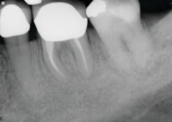Figure 4: Six-month recall—case 2 Figure 4: Six-month recall—case 2