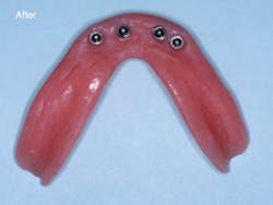 Christensen After Christensen After