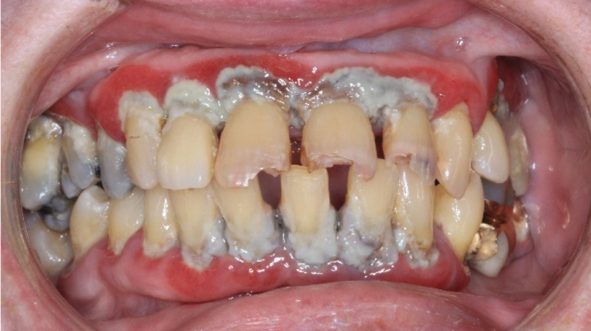 2002 De Cgiv P08 5e4ab198aa8f8