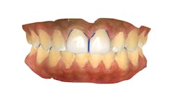 Figure 6: Digital model of final designs Figure 6: Digital model of final designs