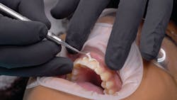 Figure 12: An easy clean-up was facilitated. Figure 12: An easy clean-up was facilitated.