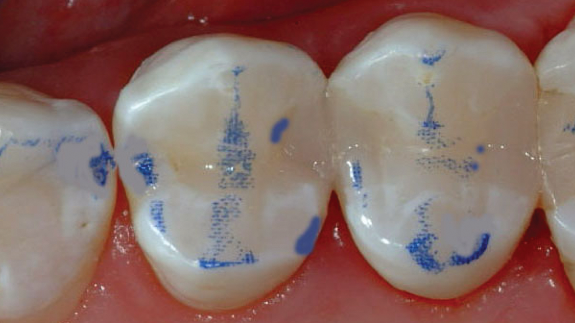 2003 De Cchr P03 5e5eab1ed6b55