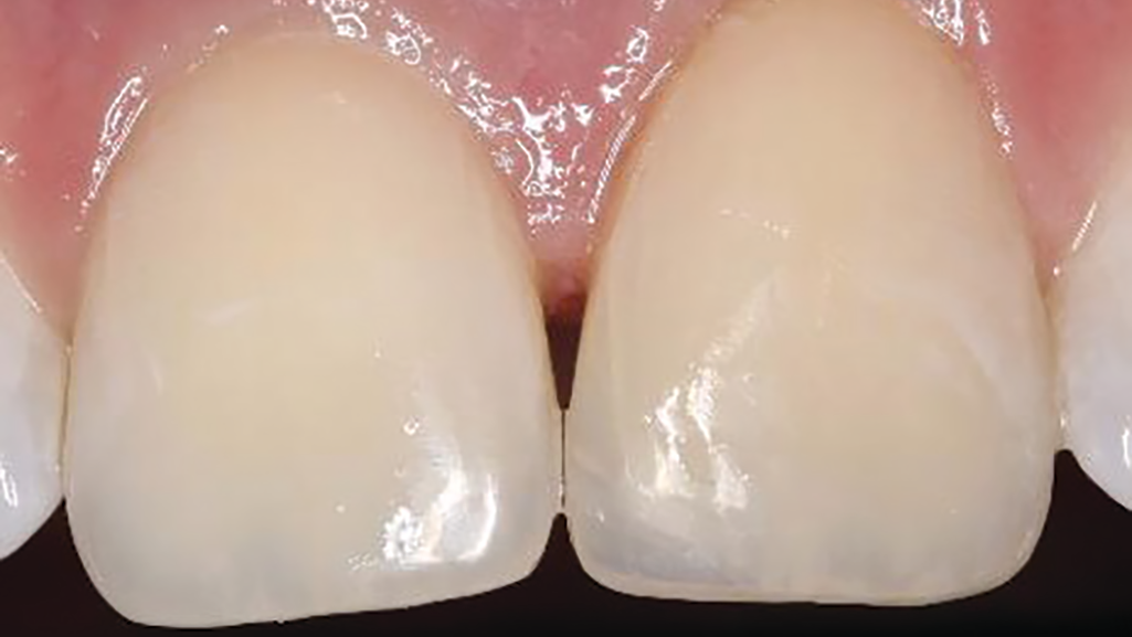 2003 De Clam P06 5e6165aa128bd