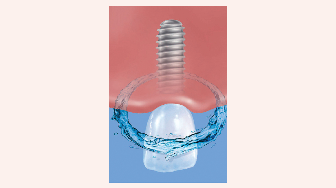 2003 Rd Hwin Thumb 5e692ee1b4cf2