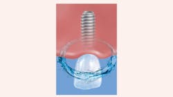 2003 Rd Hwin Thumb 5e6aa111b67a1 2003 Rd Hwin Thumb 5e6aa111b67a1