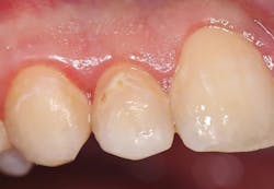 2003 De Clam P01 2003 De Clam P01