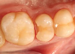 2003 De Clam P03 2003 De Clam P03