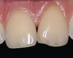 2003 De Clam P05 2003 De Clam P05