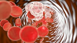 Copyright Katerynakon Dreamstime Inflammation In Blood Vessels 5e8798ce6e862 Copyright Katerynakon Dreamstime Inflammation In Blood Vessels 5e8798ce6e862