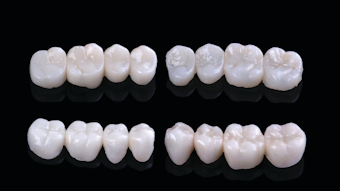 Moving Away From Metal Dental Economics