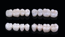 Figure 7: Finished LuxaCrown prototypes Figure 7: Finished LuxaCrown prototypes