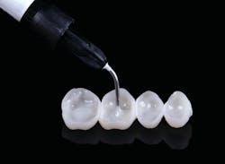 Figure 8: Bonding of prototypes with LuxaFlow Figure 8: Bonding of prototypes with LuxaFlow