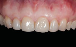 Figure 11: Pre-op frontal view Figure 11: Pre-op frontal view