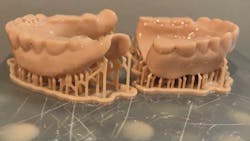 Figure 1: 3-D printed dentures Figure 1: 3-D printed dentures