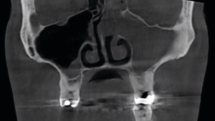 2008 De Ccla P01 5f3177c02ecb5