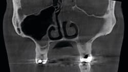 2008 De Ccla P01 5f3177c02ecb5 2008 De Ccla P01 5f3177c02ecb5