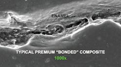 Figure 1: Typical premium, popular, so-called &ldquo;bonded&rdquo; composite adjacent to etched enamel, showing lack of marginal adaptation at 1,000x on a scanning electron microscope. Photo courtesy of TRAC Research, CR Foundation.