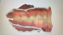 Digital scan of pediatric dentition